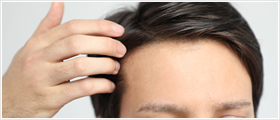男性型脱毛症（AGA）男性更年期障害（LOH 症候群）